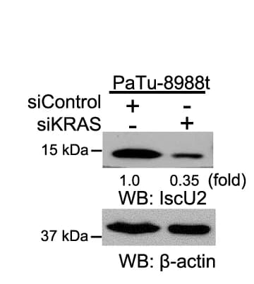 Open access visualization of Gel, Immunoblot Analysis, IscU2, mRNA Expression Analysis, KRAS