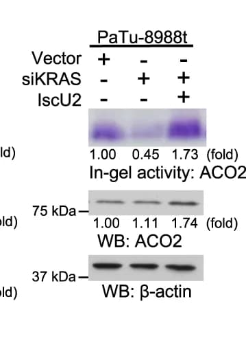 Open access visualization of Gel, Mitochondrial ACO2 activity, In-Gel Activity Assay, Immunoblot Analyses, Antibodies