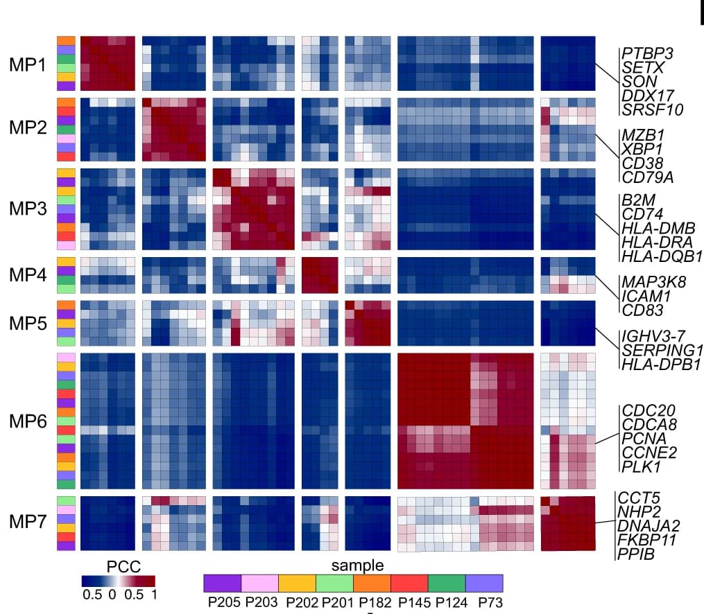 Open access visualization of Heatmap, Intratumor programs, PCNS DLBCL patients, NMF algorithm, Pearson correlation coefficient