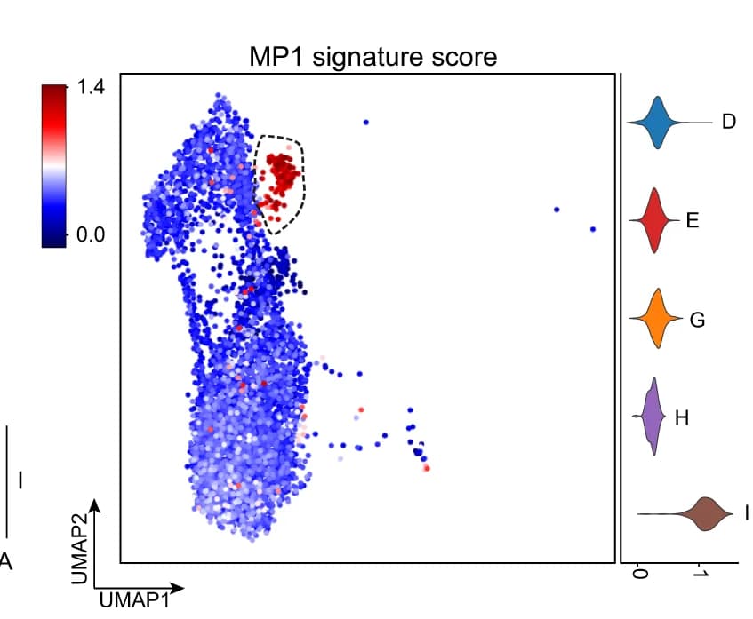Open access visualization of UMAP, Scatter Plot, Violin Plot, Malignant Cells, MP1 signature score