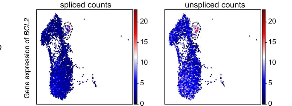 Open access visualization of Scatter Plot, UMAP, Malignant Cells, Spliced gene counts, Unspliced gene counts