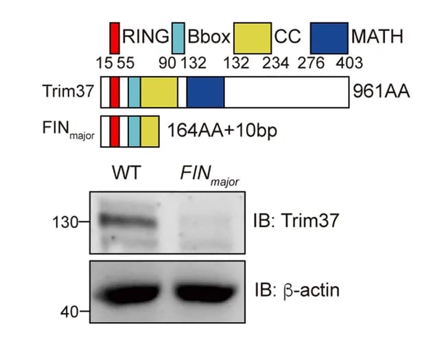 Open access visualization of Gel, Illustration, Schematic Presentation, WT Trim37, FIN Major Mutant