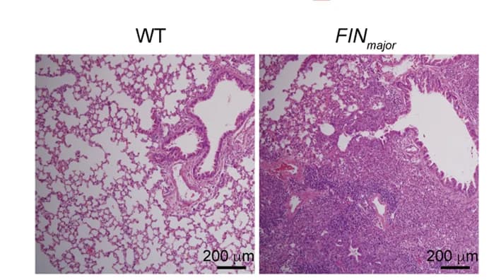 Open access visualization of Microscopy, Histopathological Analysis, H&E Staining, PR8 Influenza Infection