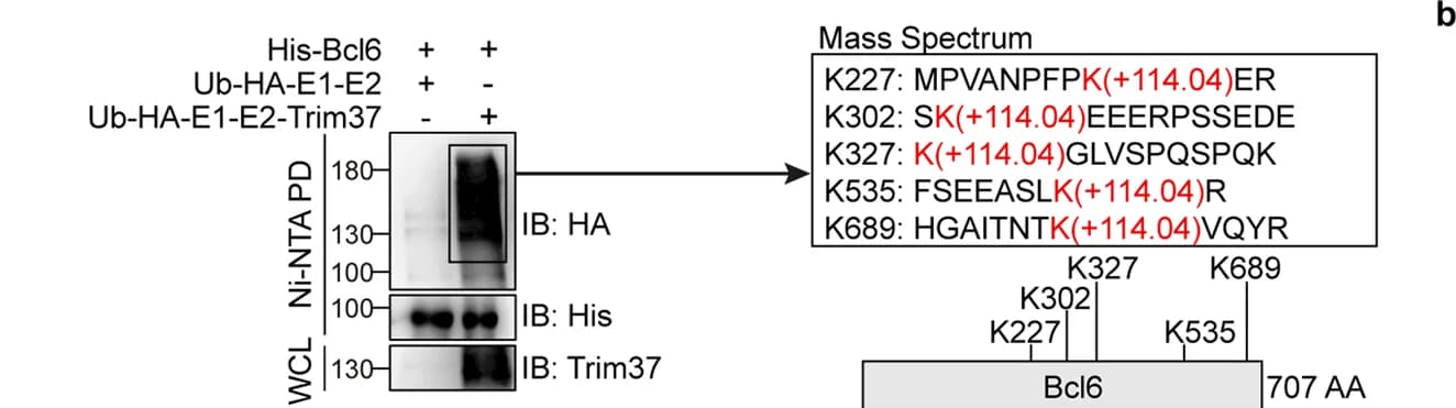 Open access visualization of Gel, Illustration, Ubiquitination, Mass Spectrometry, E. coli