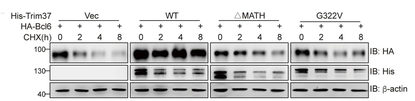 Open access visualization of Gel, Immunoblot analysis, Bcl6, HEK293T cells, HA-tagged Bcl6