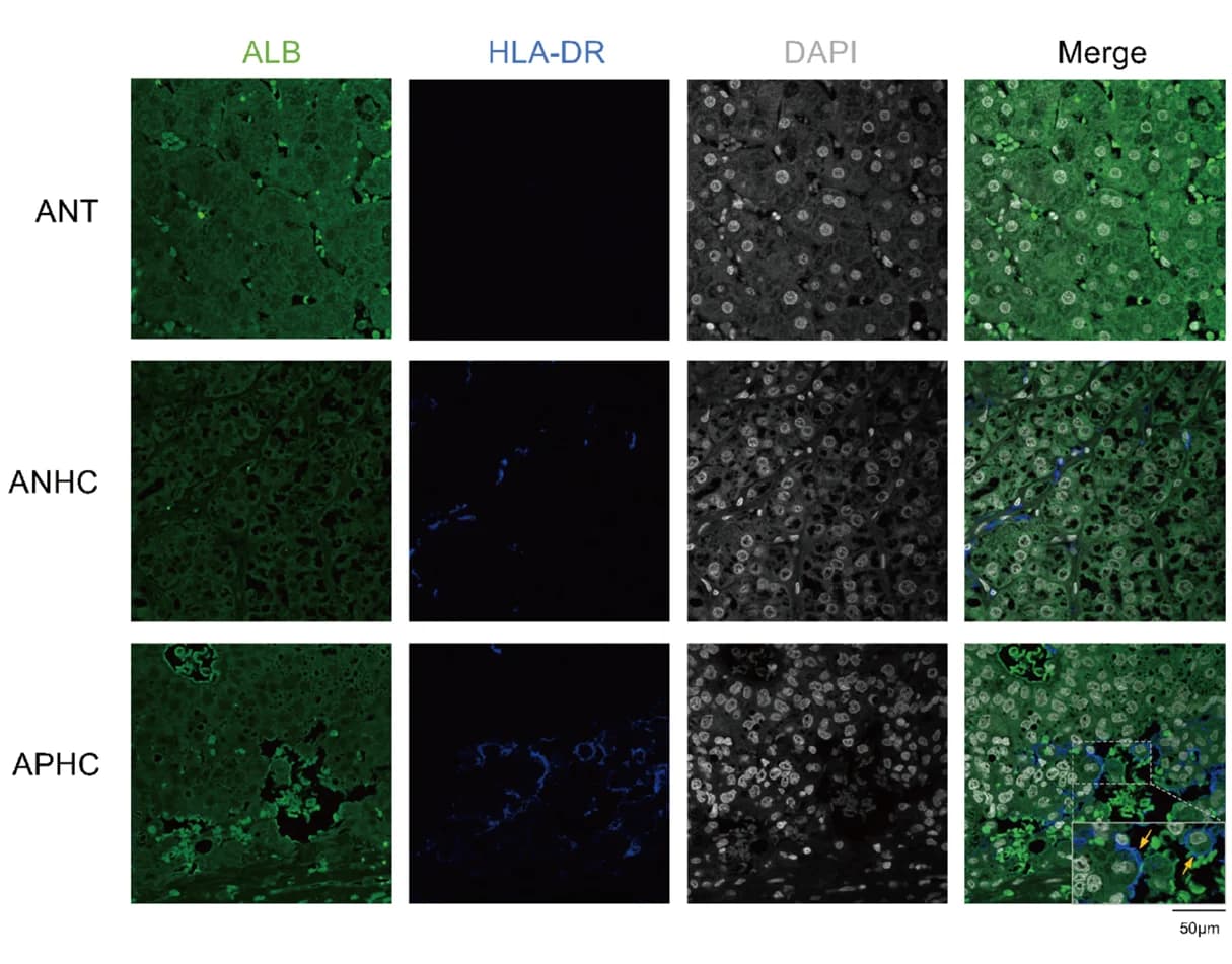Open access visualization of Microscopy, Multiplex IHC Staining, HLA-DR, ANT, ANHC