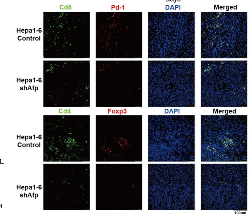 Open access visualization of Microscopy, Multiplex IHC Staining, Cd8 + Pd-1 + T Cells, Tregs, CD4 + Foxp3 + Cells