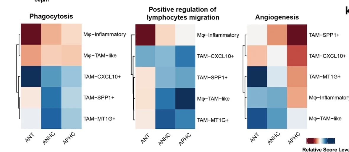 Open access visualization of Heatmap, Clustered, Heatmaps, Gene Expression, Macrophages
