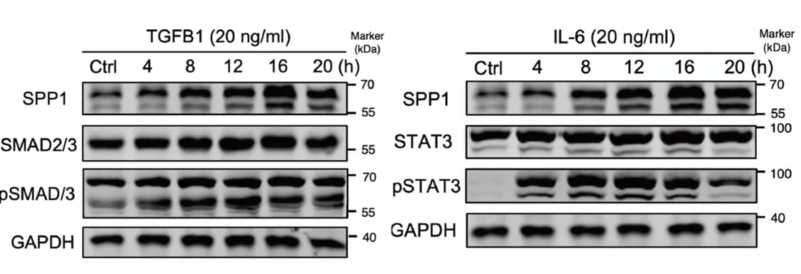 Open access visualization of Gel, Western blot, Protein expression, TGF-β1, IL6