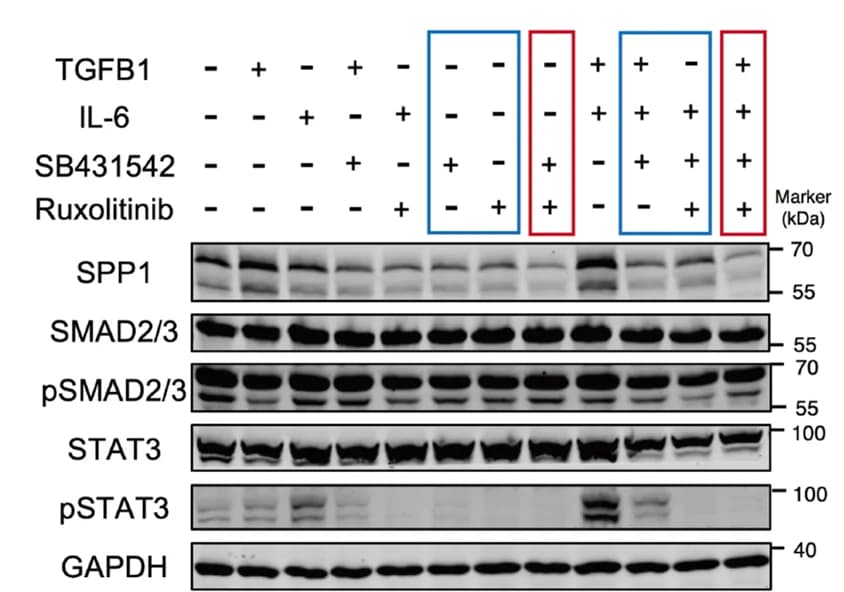 Open access visualization of Gel, Western blot, Protein level, TGF-β1, IL6