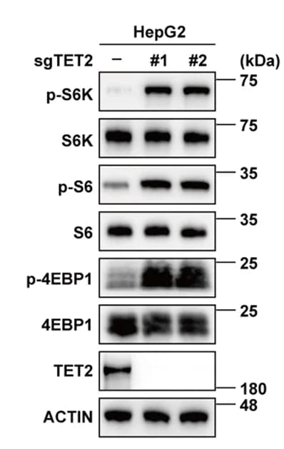 Open access visualization of Gel, Tumor Cells, Phosphorylation, S6K, S6