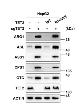 Open access visualization of Gel, Re-introduction, WT TET2, Catalytic Mutant TET2 (R1896S), Upregulation