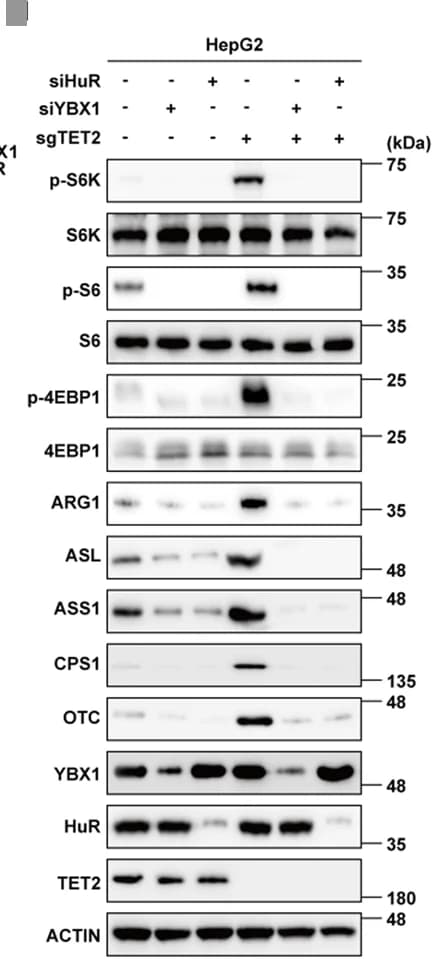 Open access visualization of Gel, YBX1 Knockdown, HuR Knockdown, Protein Levels, Urea Cycles Enzymes