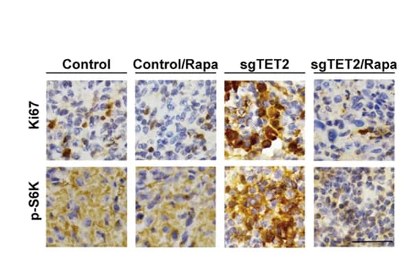 Open access visualization of Microscopy, IHC analysis, Tumor, Nude mice, Antibodies