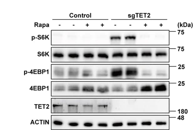 Open access visualization of Gel, Western blot, Tumor, Nude mice, Antibodies