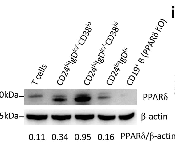 Open access visualization of Gel, PPARdelta, Western Blot, B Cell Subsets, T Cells