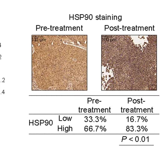Open access visualization of Microscopy, Table Image, HSP90, ESCC biopsy, 5-FU-treatment