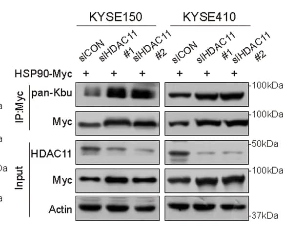 Open access visualization of Gel, HDAC11, Kbu Modification, HSP90, Knockdown