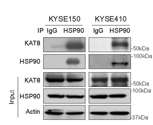 Open access visualization of Gel, Immunoprecipitation Assay, HSP90, KAT8, Protein Interaction