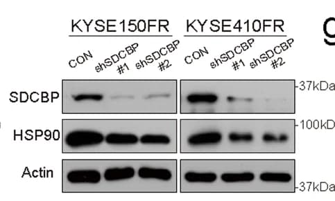 Open access visualization of Gel, HSP90, SDCBP Knockdown, ESCC Cells