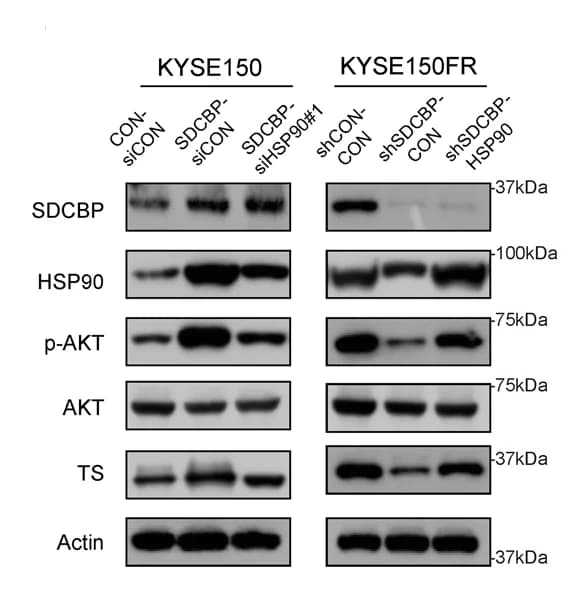 Open access visualization of Gel, Western Blot, SDCBP, HSP90, p-AKT
