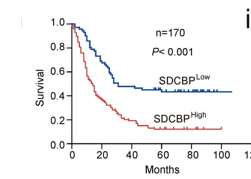 Open access visualization of Survival Curve, Kaplan-Meier Analysis, Overall Survival, ESCC Patients, SDCBP Expression