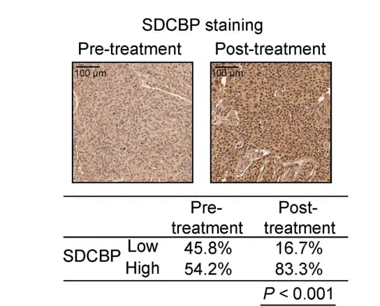 Open access visualization of Microscopy, Table Image, SDCBP, ESCC Patients, 5-FU