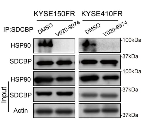 Open access visualization of Gel, IP Assay, V020-9974, SDCBP-HSP90 Interaction, HDAC11-HSP90 Interaction