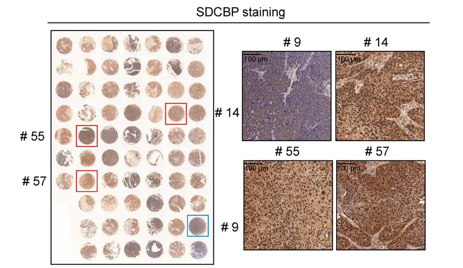 Open access visualization of Microscopy, Photo, Representative Images, SDCBP, PDX Models