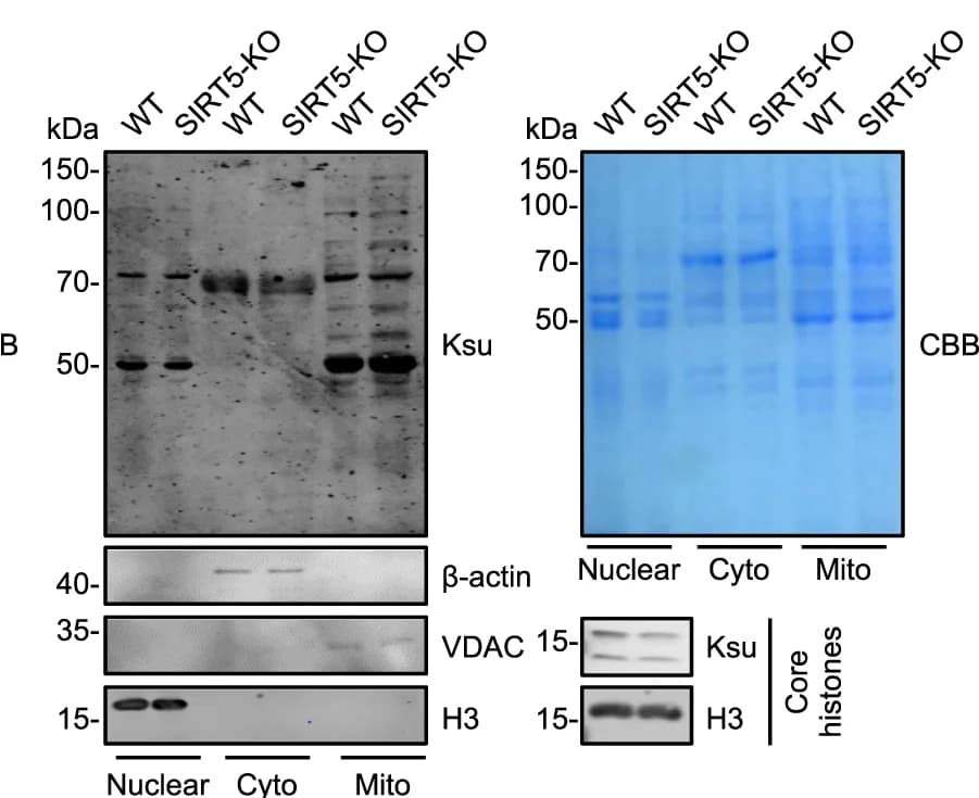 Open access visualization of Gel, WB analysis, Succinylated proteins, Nuclear fraction, Cytosolic fraction
