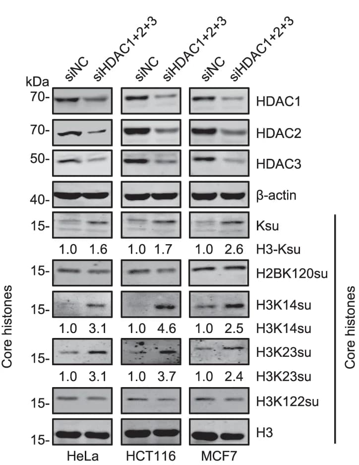 Open access visualization of Gel, WB analysis, Histone succinylation, HeLa cells, HCT116 cells