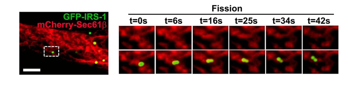 Open access visualization of Microscopy, Merged Image, Endoplasmic Reticulum, mCherry-Sec61β, GFP-IRS-1