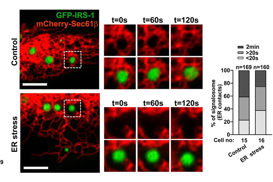 Open access visualization of Microscopy, Stacked Bar Plot, Live Imaging, GFP-IRS-1, Endoplasmic Reticulum