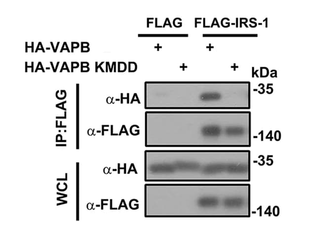 Open access visualization of Gel, FLAG-tagged IRS-1, HA-VAPB, VAPB KMDD Mutant, 293 T Cells
