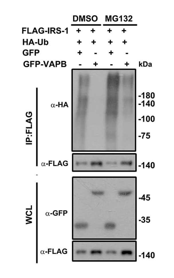 Open access visualization of Gel, FLAG-VAPB, HA-Ubiquitin, GFP, GFP-VAPB