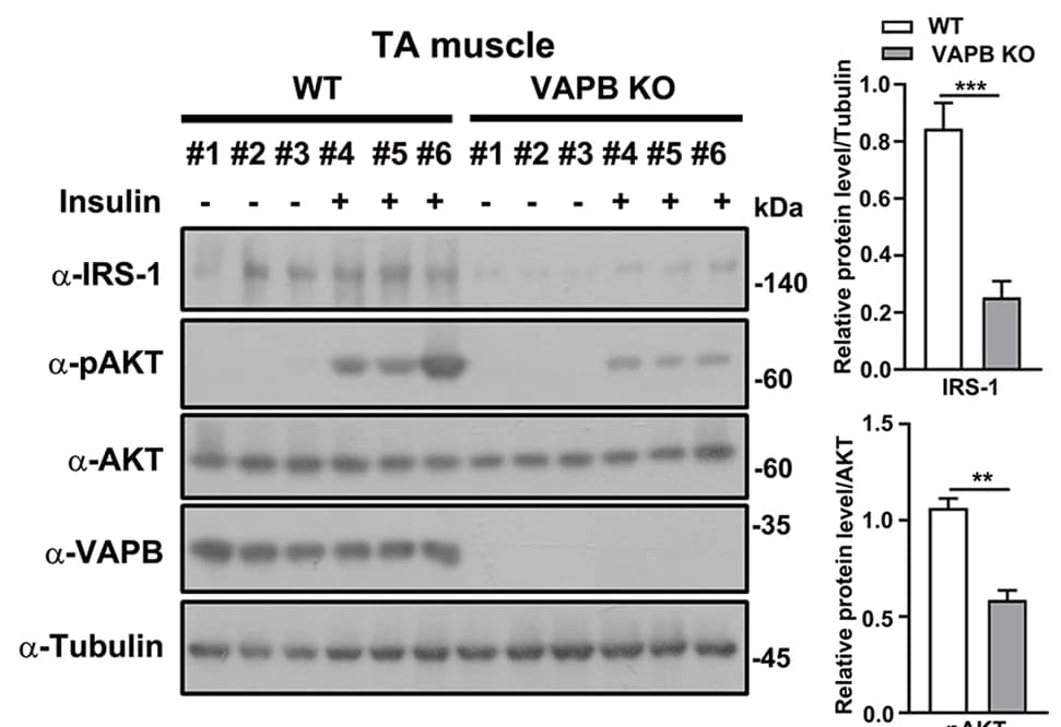 Open access visualization of Bar Plot, Gel, AKT Phosphorylation, Tibialis Anterior Muscle, Wild-type Mice