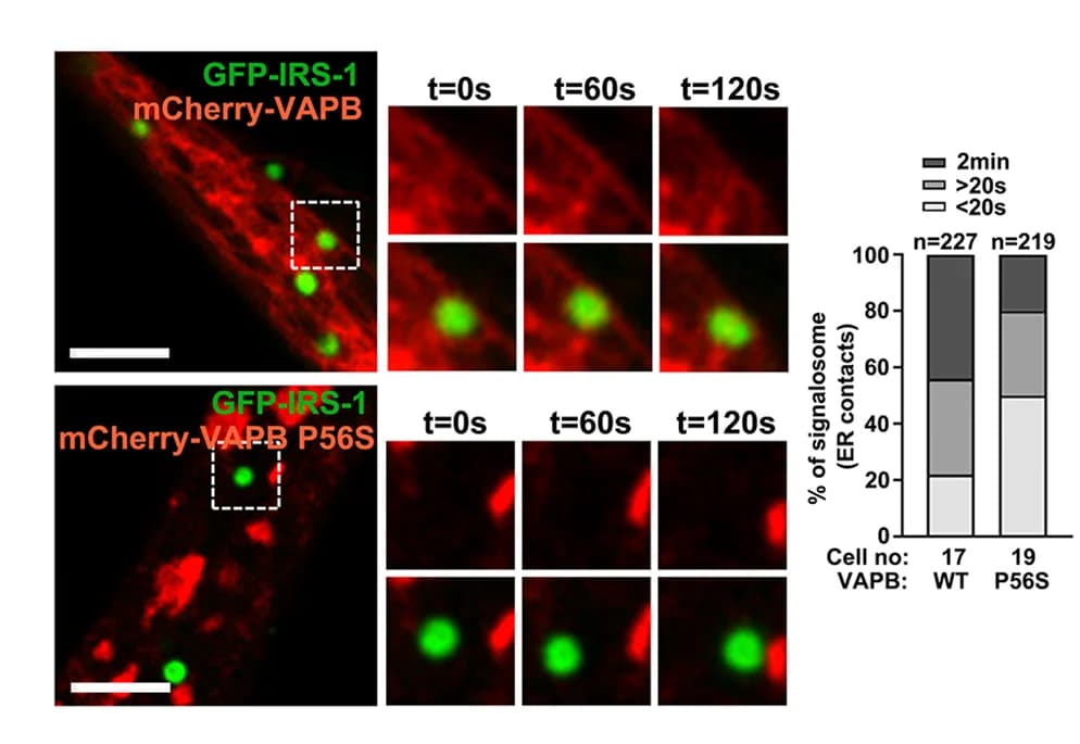 Open access visualization of Stacked Bar Plot, Microscopy, Photo, Live Imaging, GFP-IRS-1 Droplets