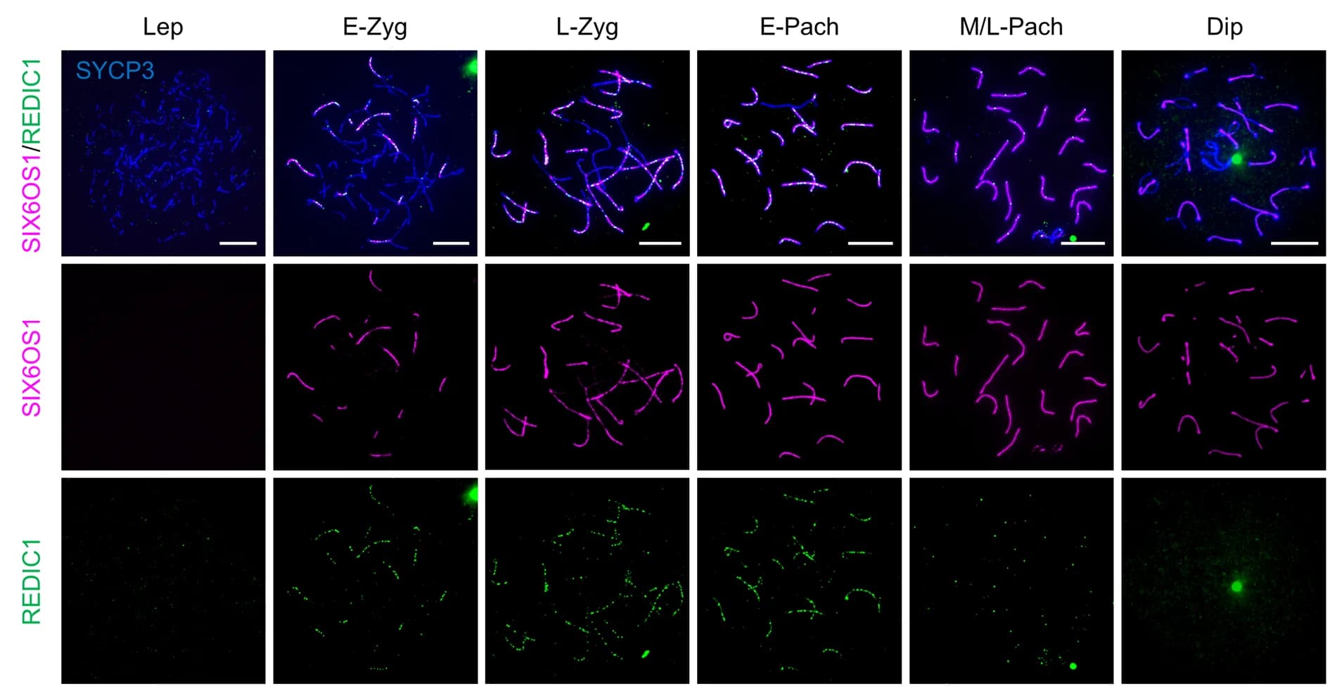 Open access visualization of Microscopy, Spermatocytes, SYCP3, REDIC1, SIX6OS1