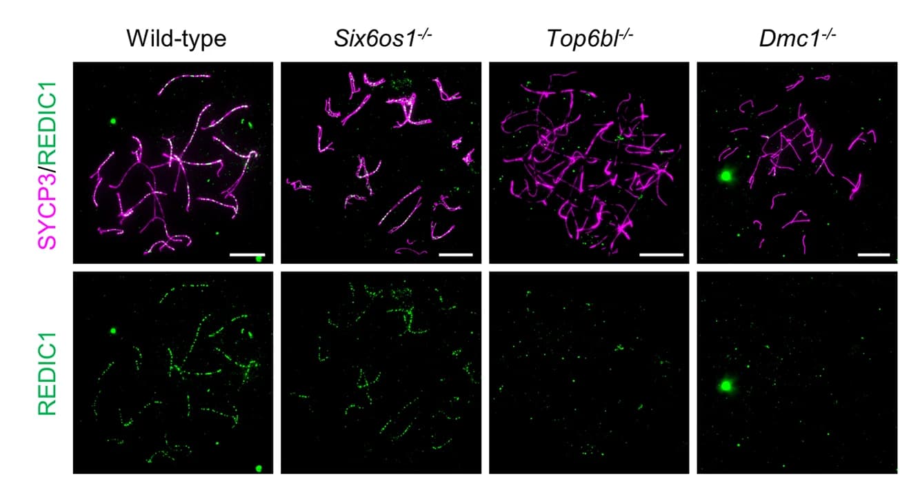 Open access visualization of Microscopy, Zygotene Spermatocytes, SYCP3, REDIC1, Wild-Type Mice