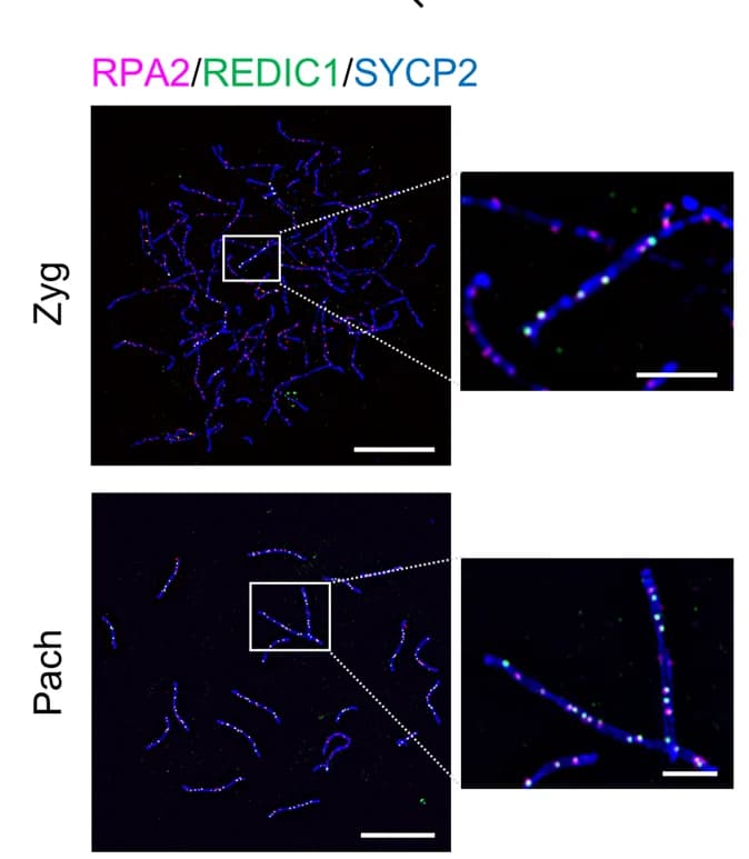 Open access visualization of Microscopy, Chromosomes, Zygotene Spermatocytes, Pachytene Spermatocytes, RPA2
