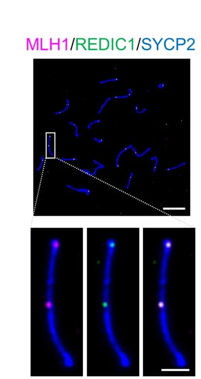 Open access visualization of Microscopy, Chromosomes, Mid-Pachytene Spermatocyte, MLH1, REDIC1