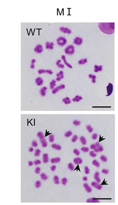Open access visualization of Microscopy, Metaphase I Spermatocytes, Giemsa Staining, Chromosomes, Mice