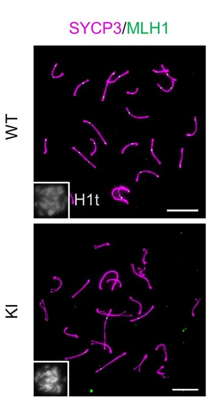 Open access visualization of Microscopy, Mid-Pachytene Spermatocytes, SYCP3, MLH1, H1t