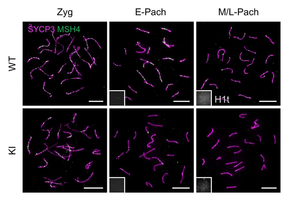 Open access visualization of Microscopy, Spermatocytes, Immunostaining, SYCP3, MSH4