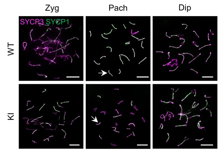 Open access visualization of Microscopy, Spermatocytes, WT Mice, Redic1 KI Mice, SYCP3