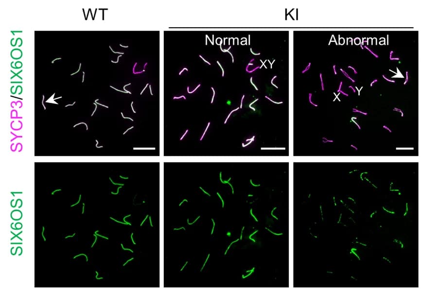 Open access visualization of Microscopy, Immunofluorescence Staining, Pachytene Spermatocytes, WT Mice, KI Mice