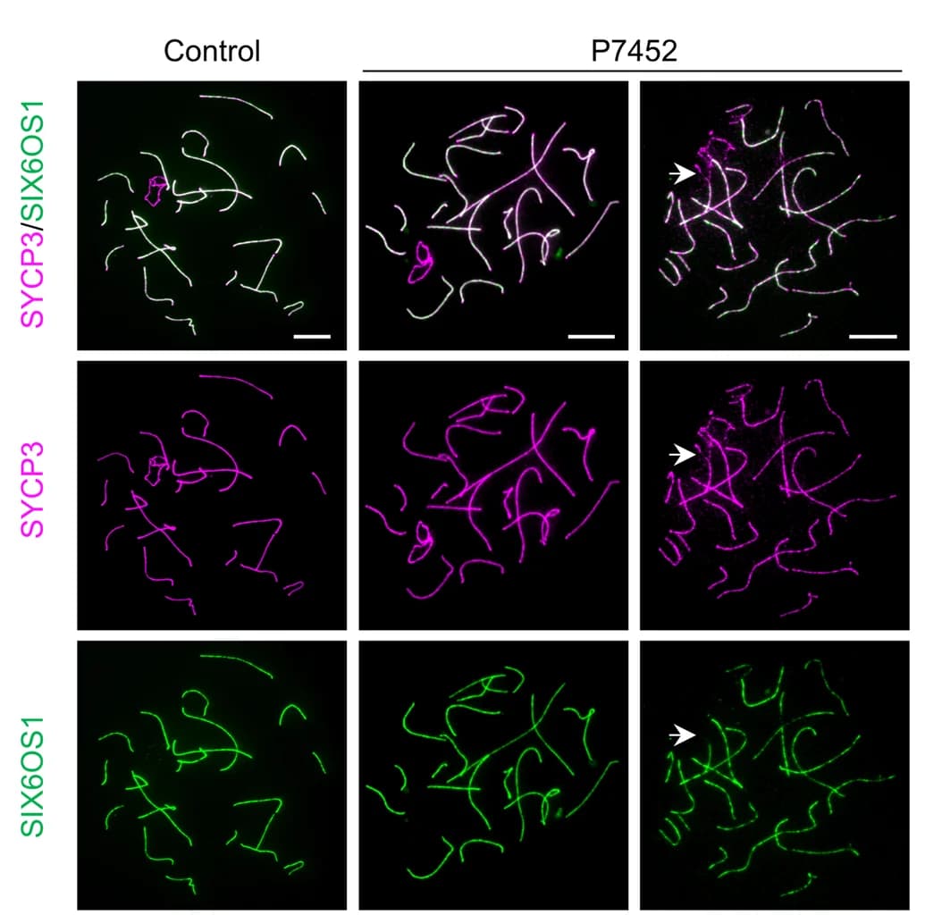 Open access visualization of Microscopy, Immunofluorescence, Pachytene Spermatocytes, SYCP3, SIX6OS1