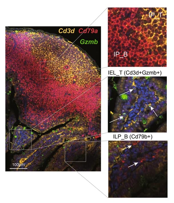 Open access visualization of Microscopy, Immunofluorescence, IF Staining, Cd3d, Cd79a