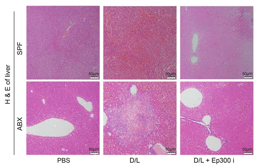 Open access visualization of Microscopy, H&E Staining, Mouse Liver, Representative Pictures