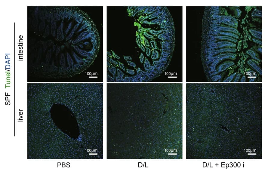 Open access visualization of Microscopy, TUNEL Staining, Mouse Liver, Mouse Intestine, D/L